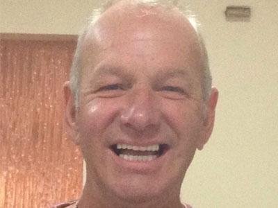 Basal implants after