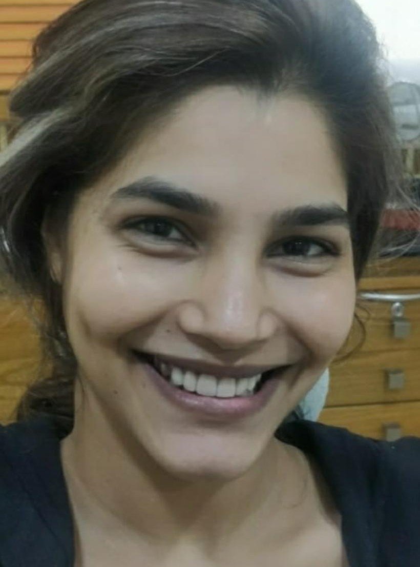 After smile makeover