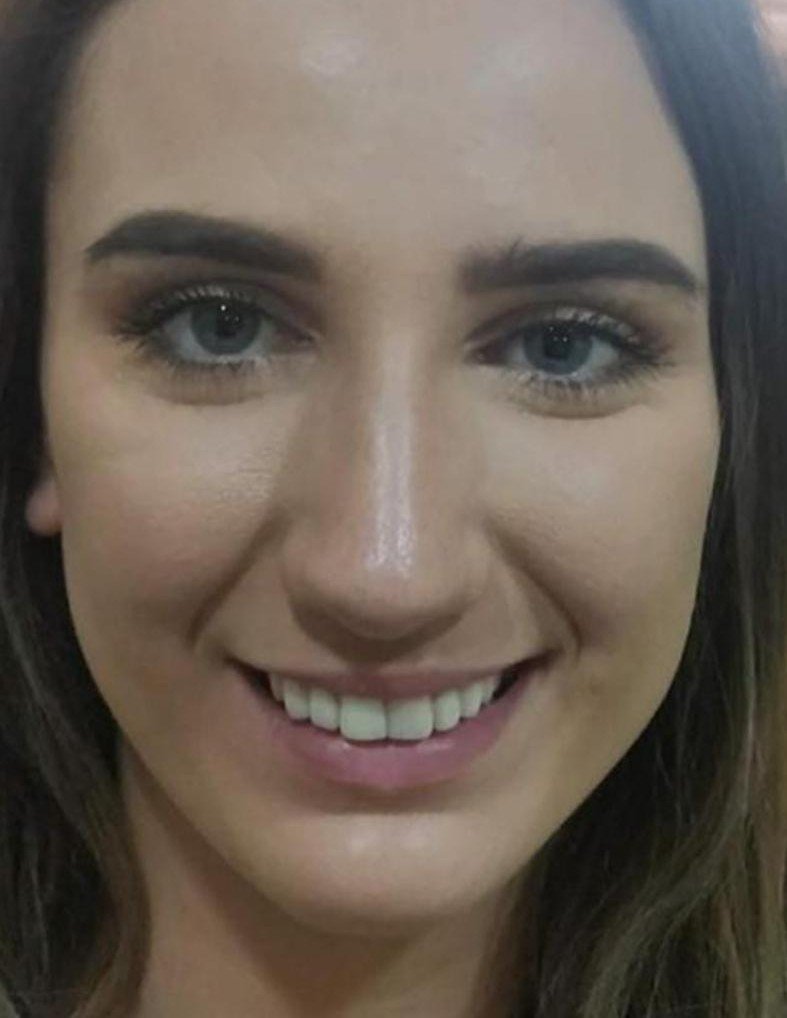 After smile makeover