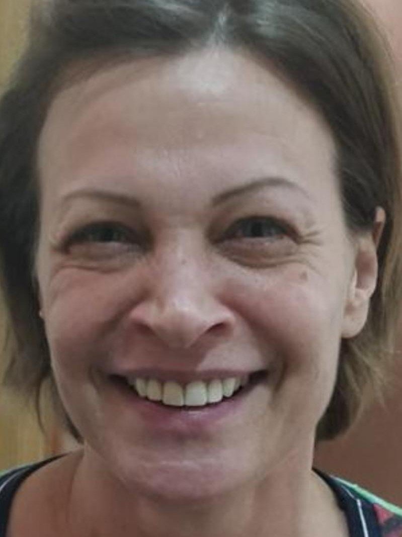 After smile makeover