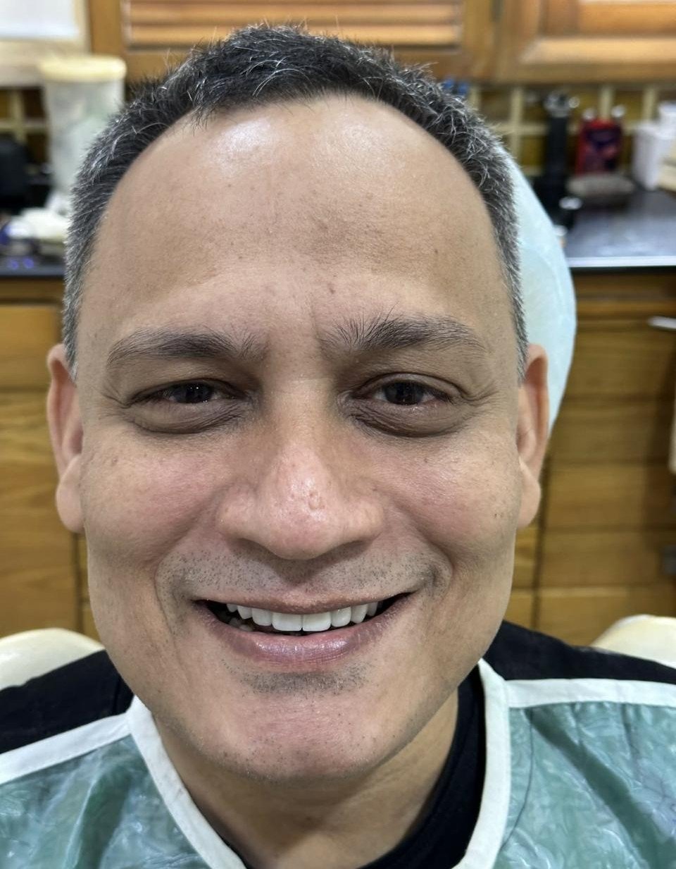 After smile makeover