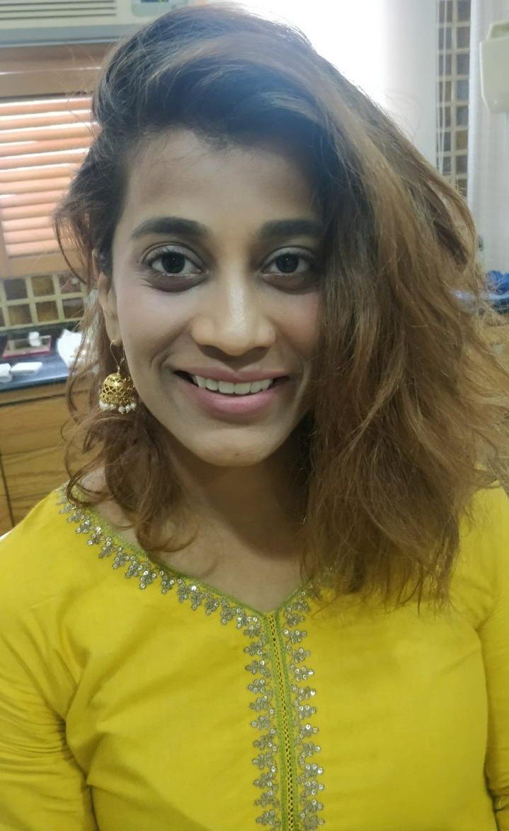After smile makeover