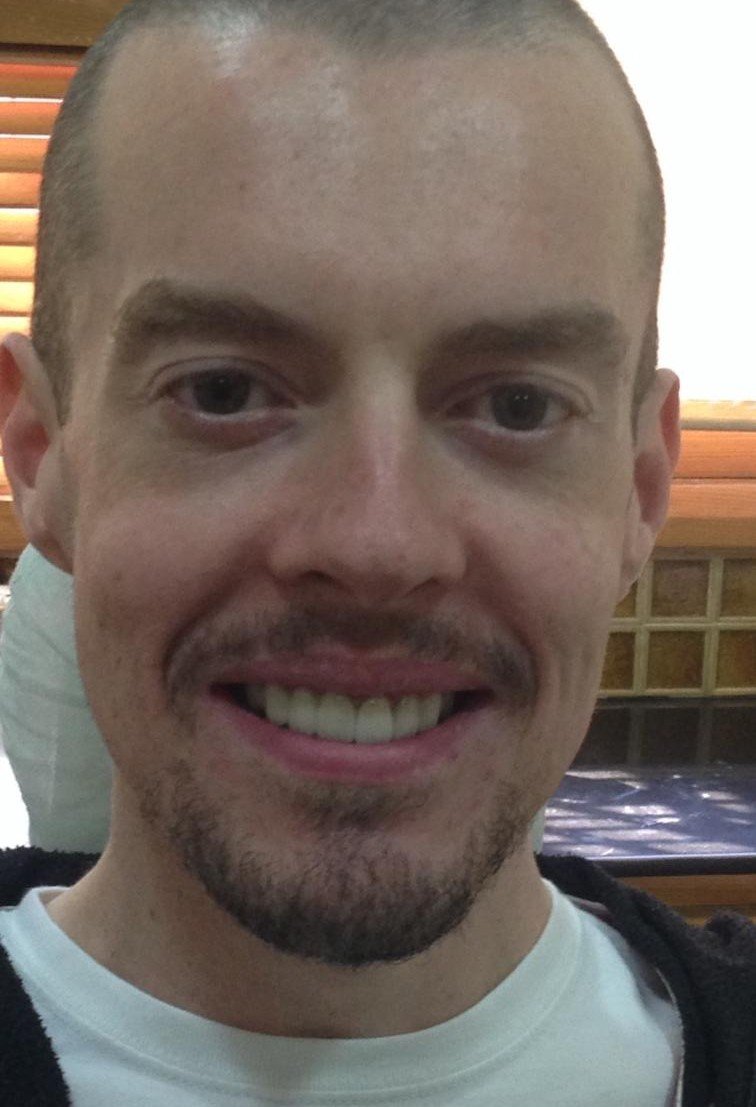 After smile makeover