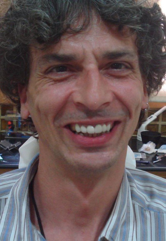 After smile makeover