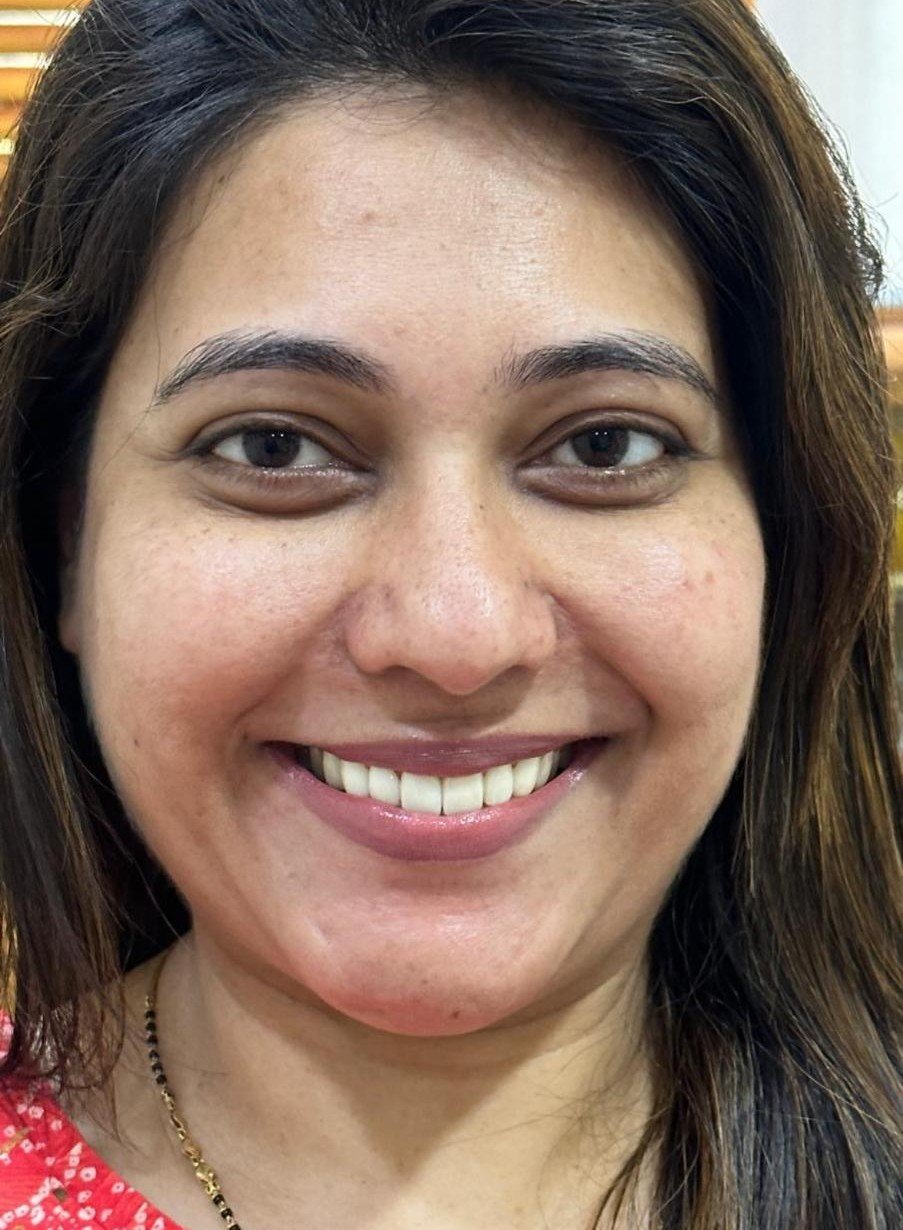 After smile makeover