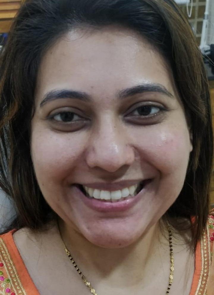 Before smile makeover