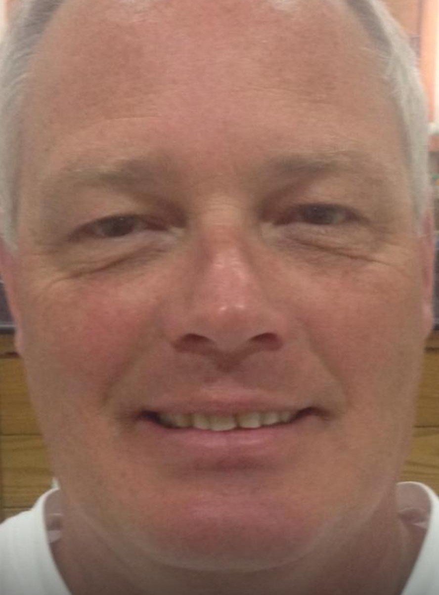 Before smile makeover