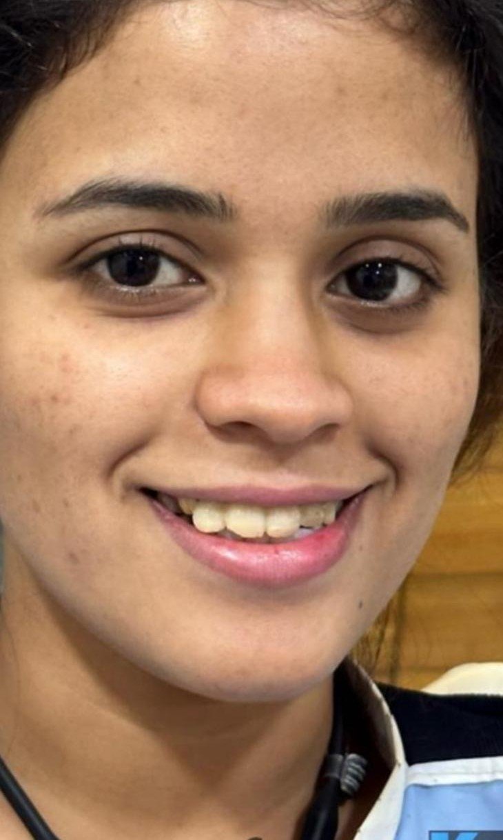 Before smile makeover