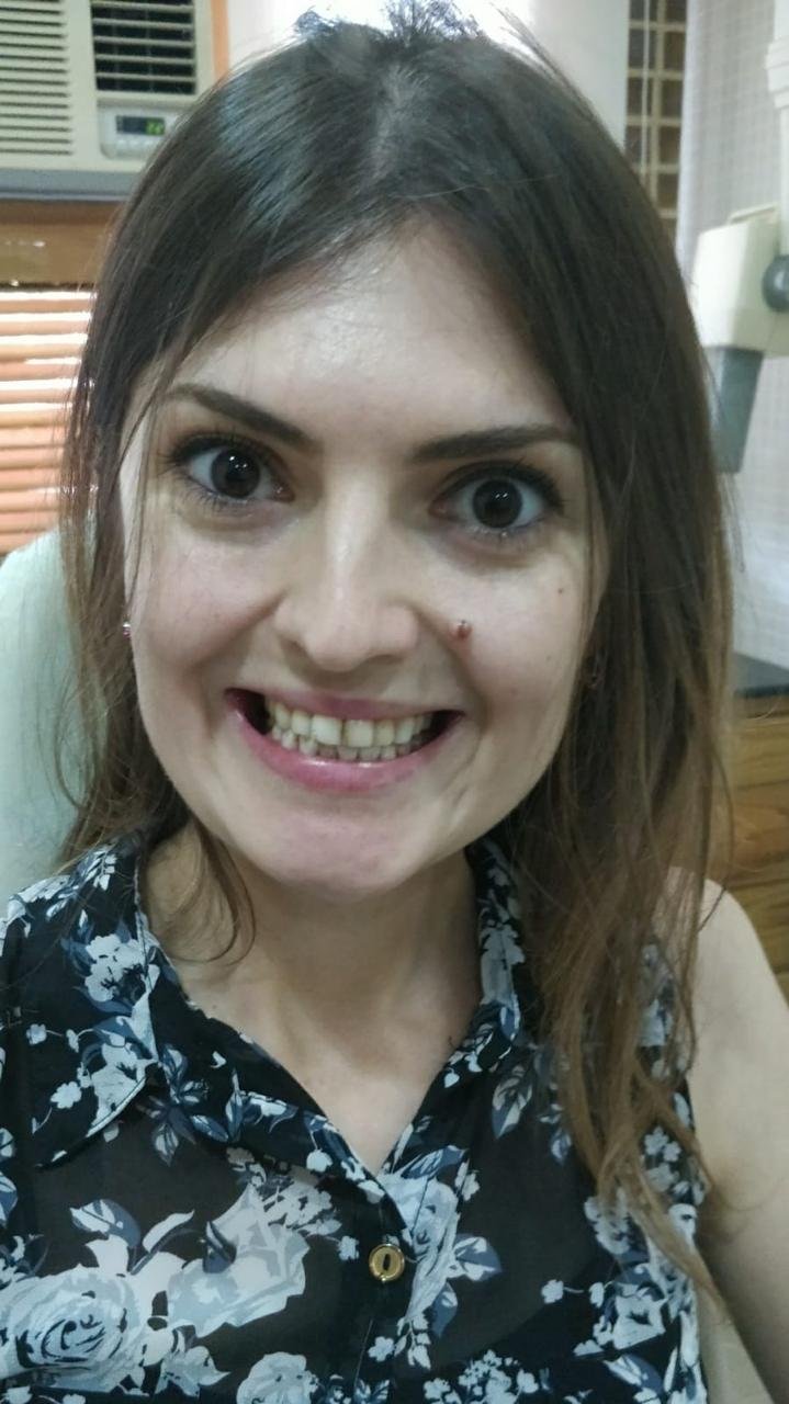 Before smile makeover