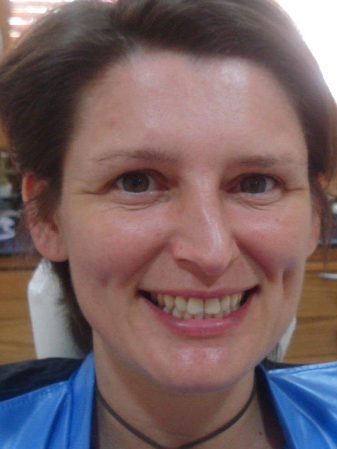 Before smile makeover