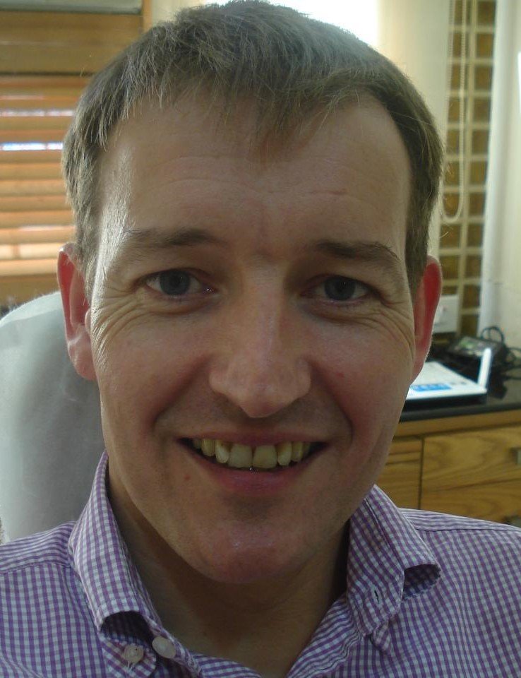 Before smile makeover