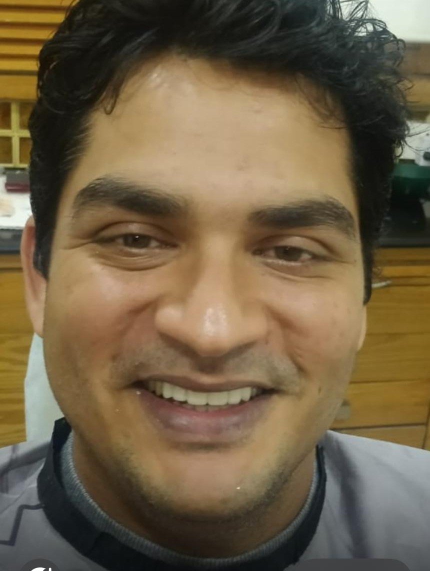 After smile makeover