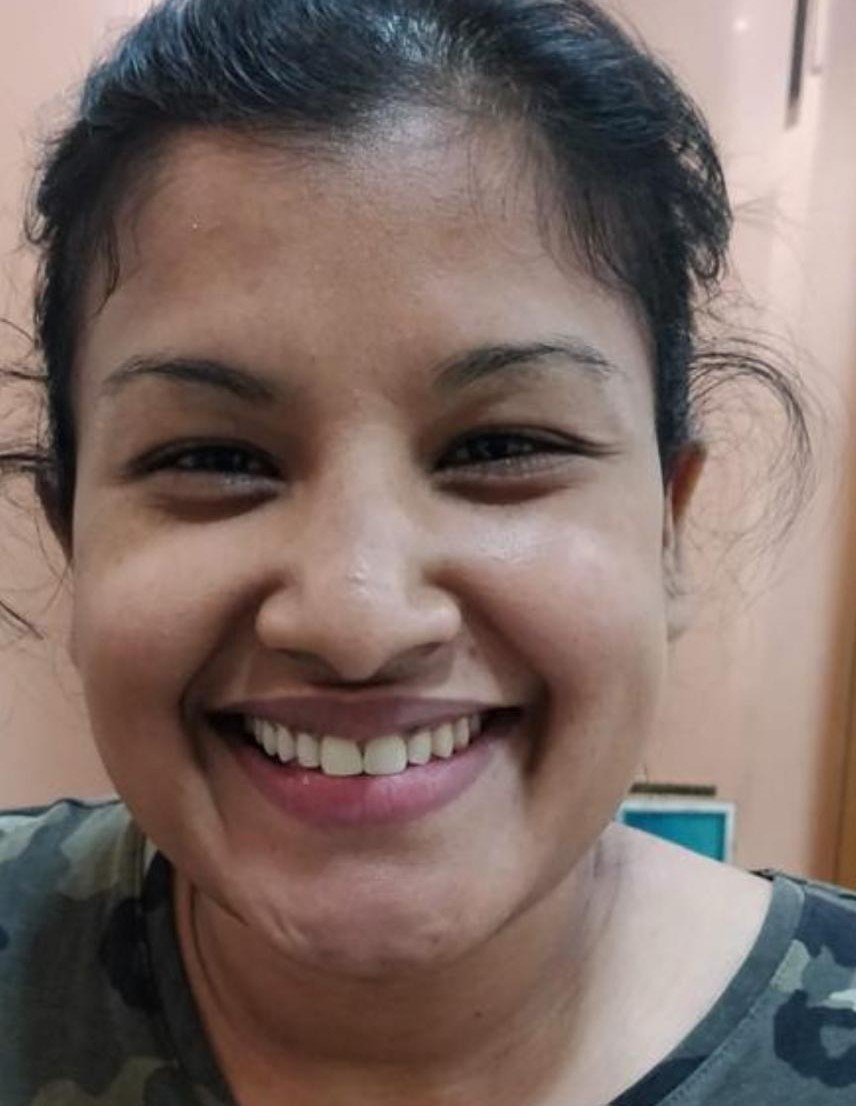 After smile makeover