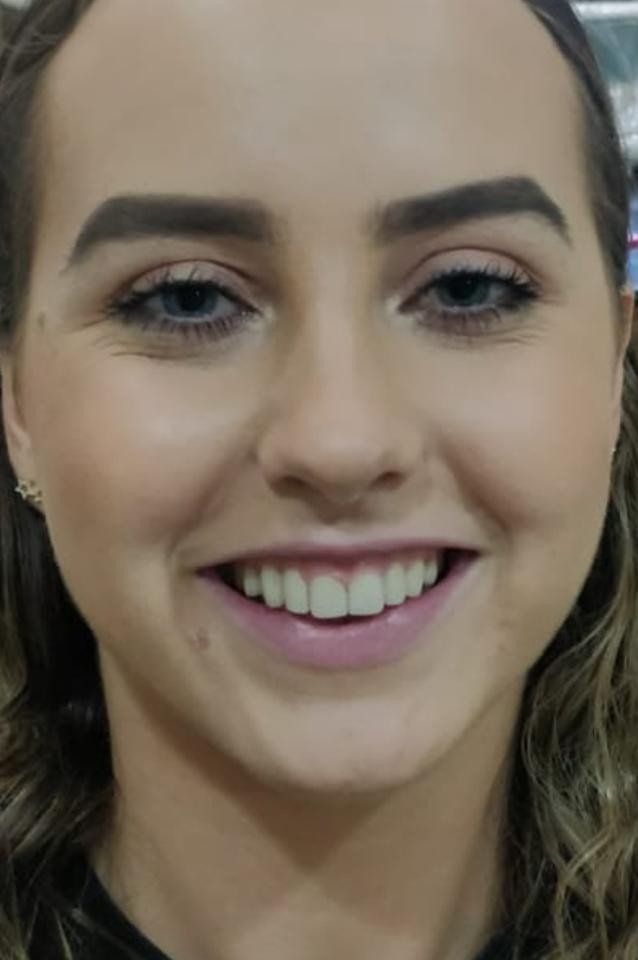 After smile makeover