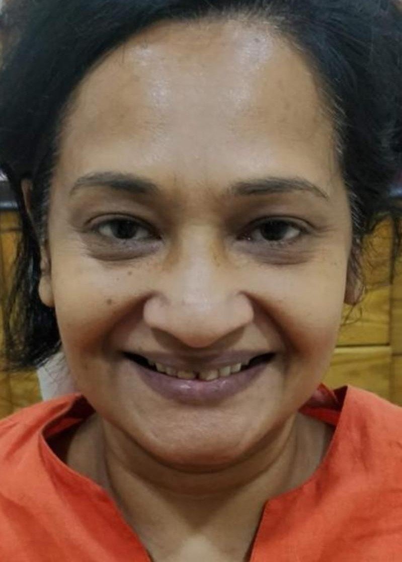 Before smile makeover